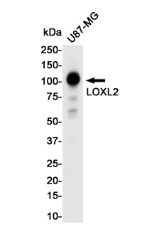 LOXL2 Rabbit Monoclonal Antibody