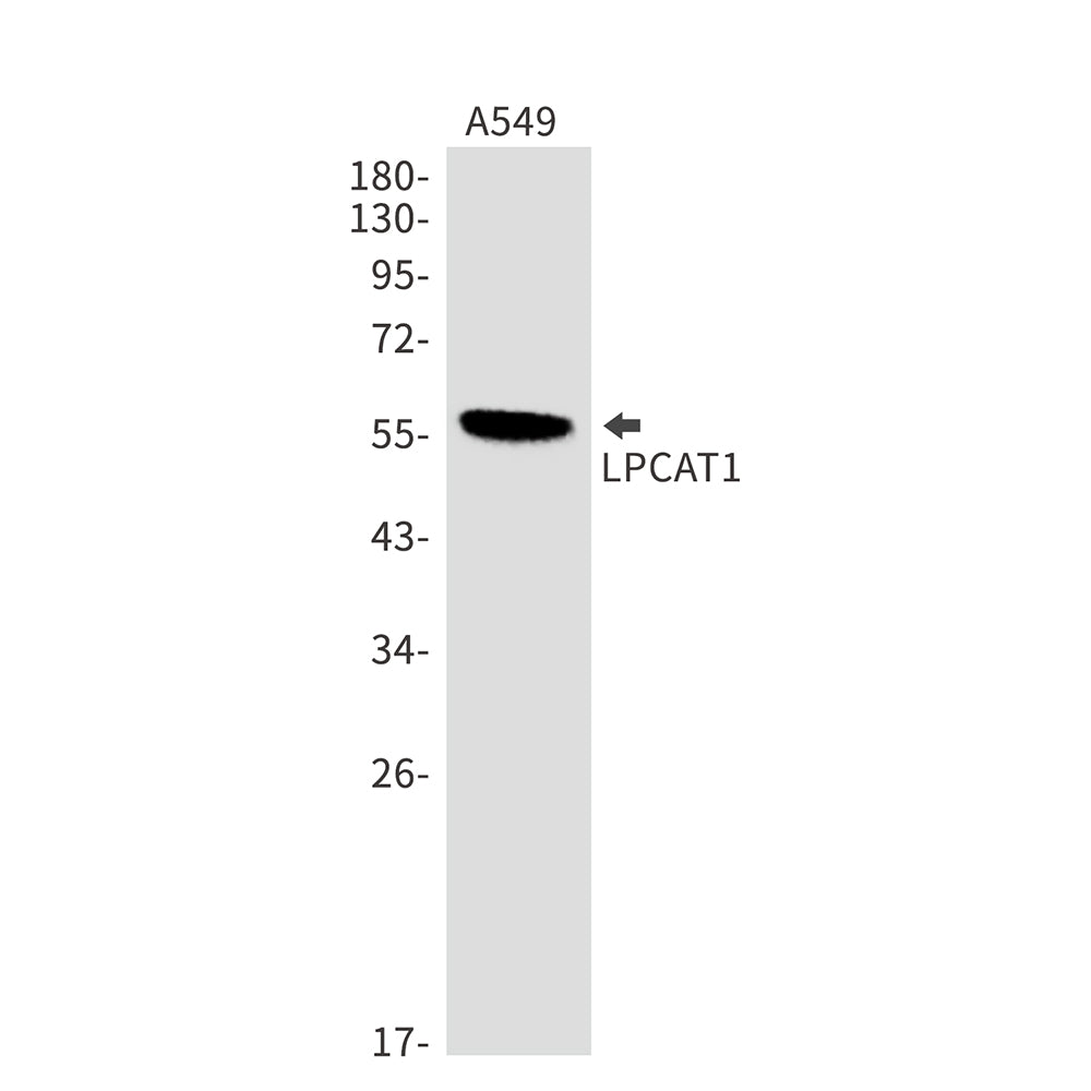 LPCAT1 Rabbit Monoclonal Antibody