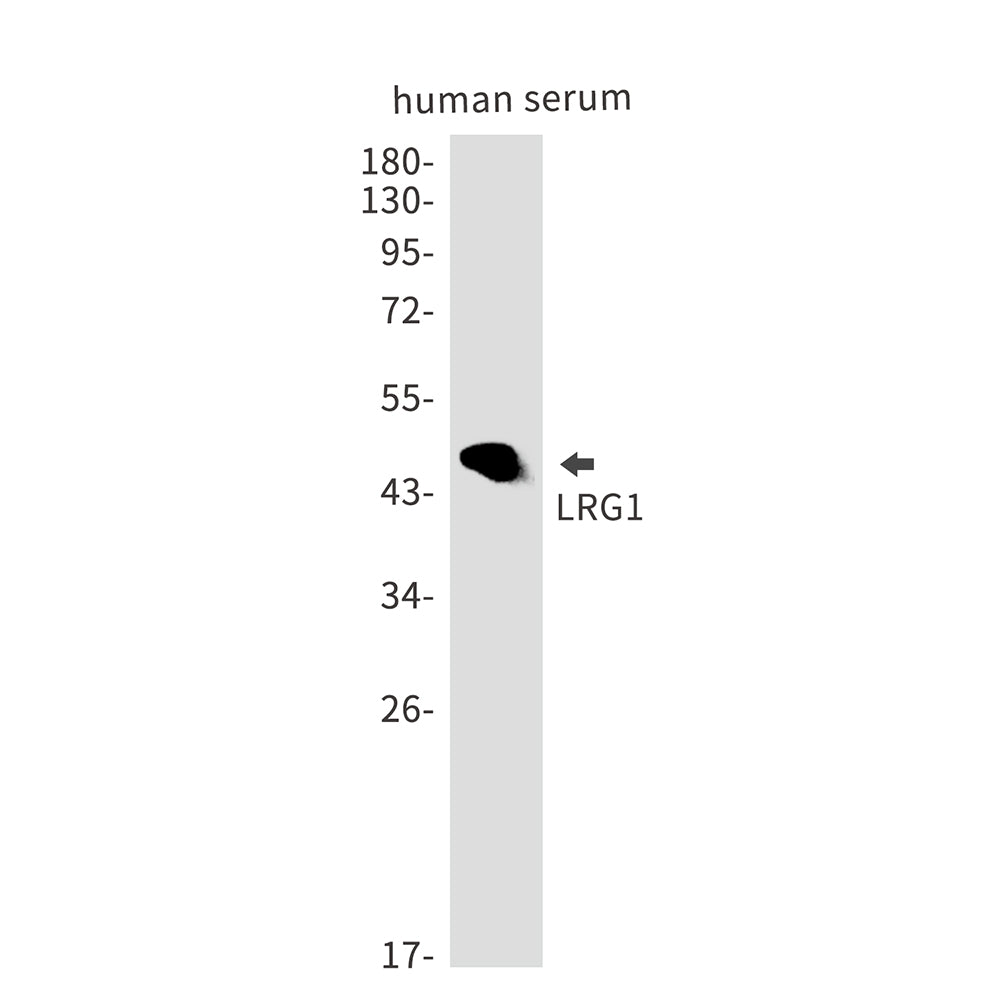 LRG1 Rabbit Monoclonal Antibody