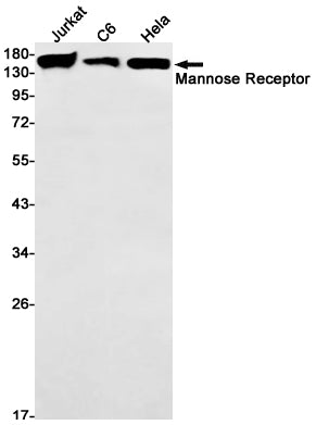 Mannose Receptor Rabbit Monoclonal Antibody