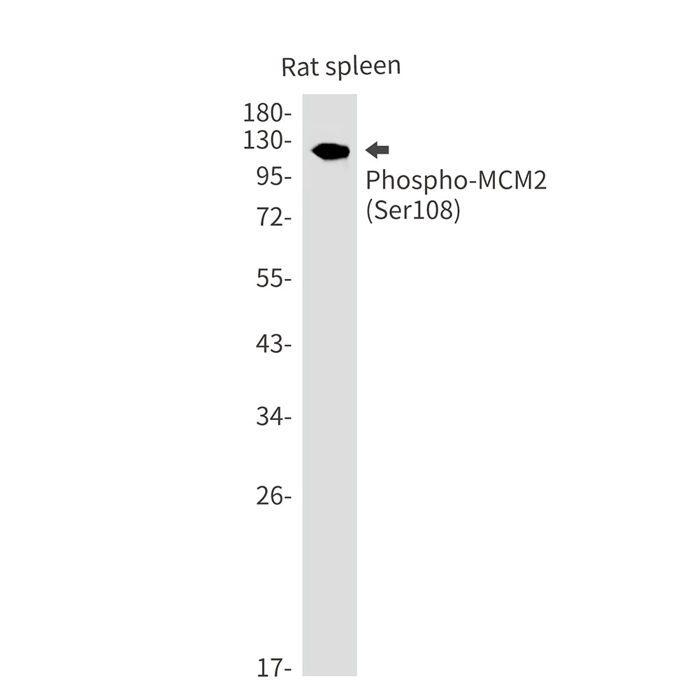 Phospho-MCM2 (Ser108) Rabbit Monoclonal Antibody