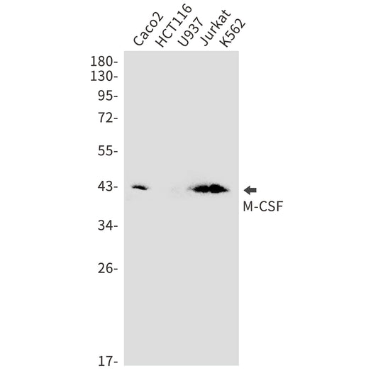 M-CSF Rabbit Monoclonal Antibody