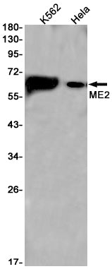 ME2 Rabbit Monoclonal Antibody