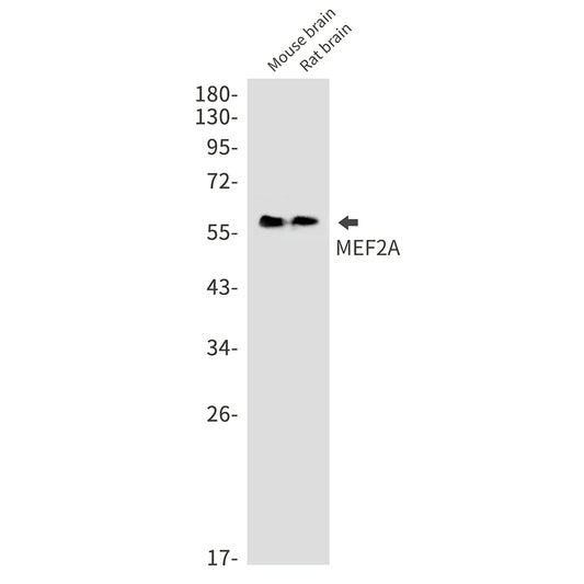 MEF2A Rabbit Monoclonal Antibody