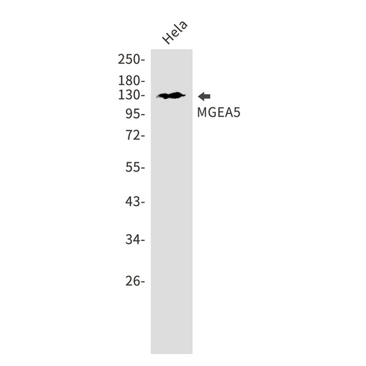 OGA Rabbit Monoclonal Antibody