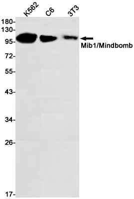 MIB1 Rabbit Monoclonal Antibody