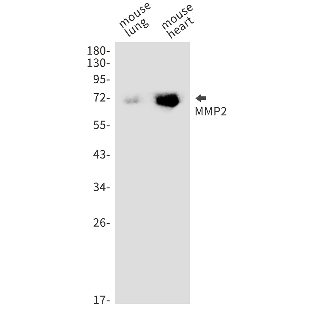 MMP2 Rabbit Monoclonal Antibody