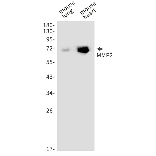 MMP2 Rabbit Monoclonal Antibody
