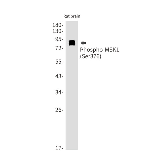 Phospho-MSK1 (Ser376) Rabbit Monoclonal Antibody