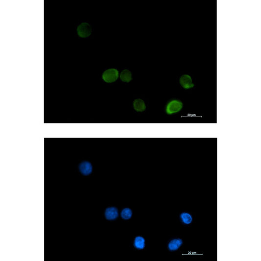 MTHFR Rabbit Monoclonal Antibody