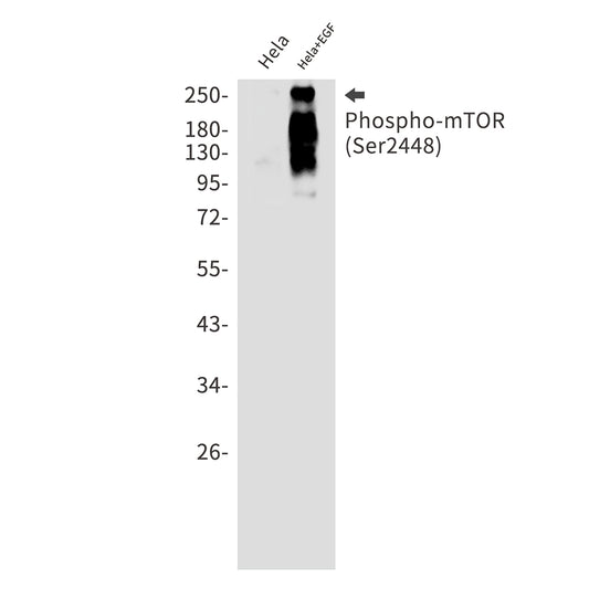 Phospho-mTOR (Ser2448) Rabbit Monoclonal Antibody
