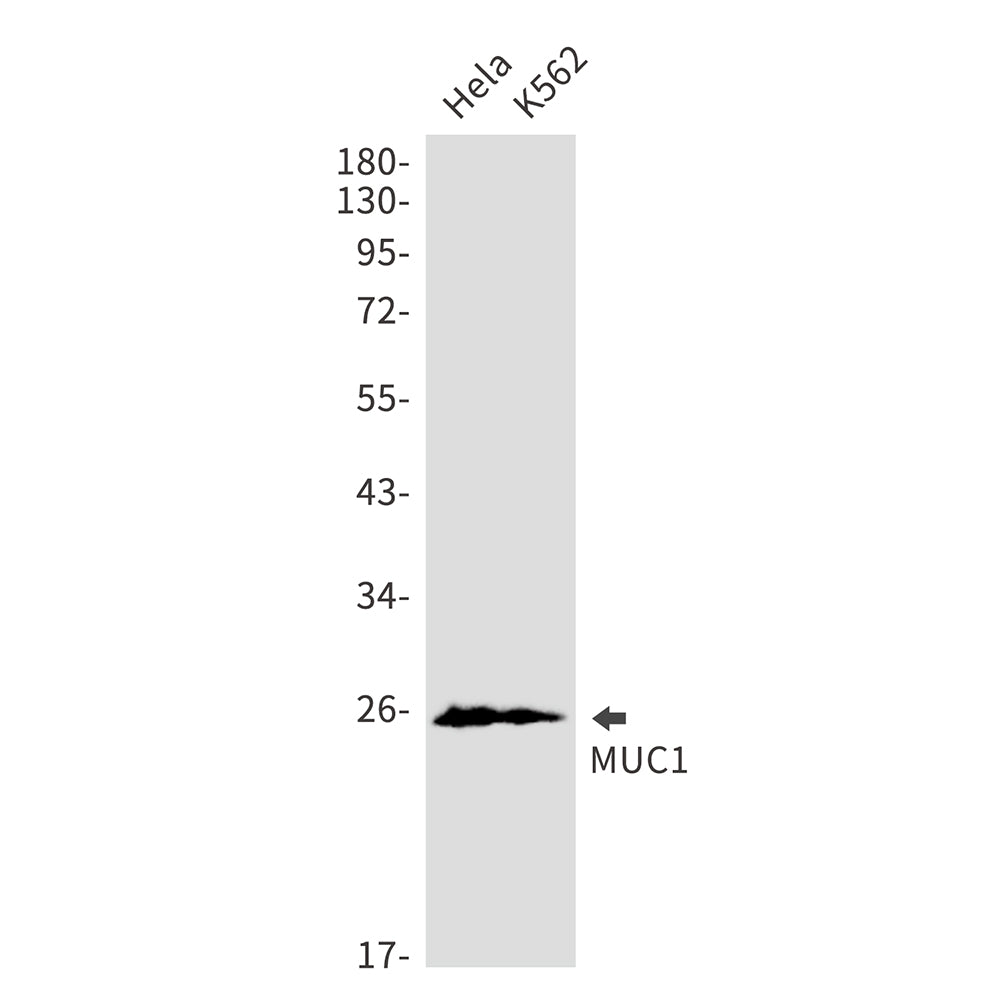 Mucin 1 Rabbit Monoclonal Antibody
