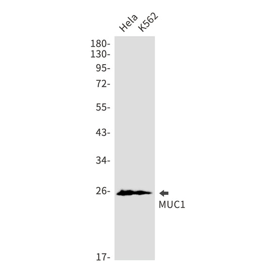 Mucin 1 Rabbit Monoclonal Antibody