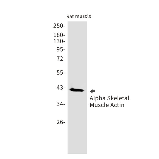 alpha Skeletal Muscle Actin Rabbit Monoclonal Antibody