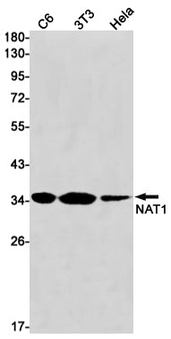 NAT1 Rabbit Monoclonal Antibody