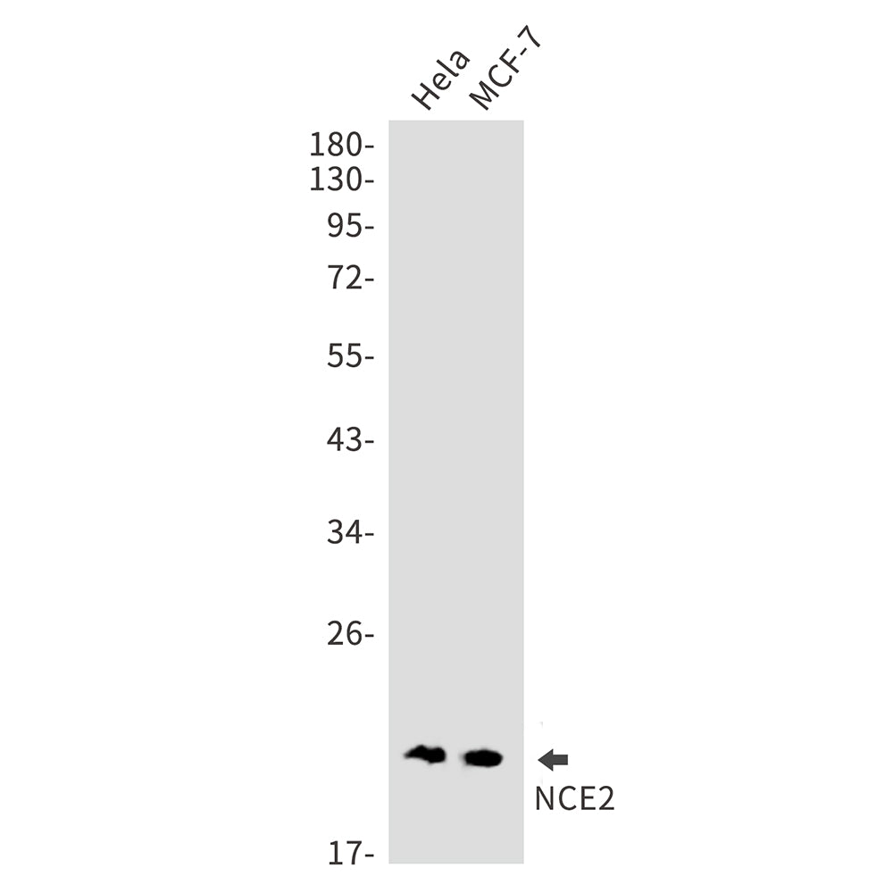 NCE2 Rabbit Monoclonal Antibody