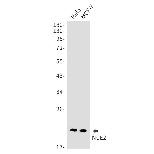 NCE2 Rabbit Monoclonal Antibody