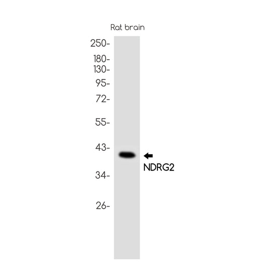 NDRG2 Rabbit Monoclonal Antibody