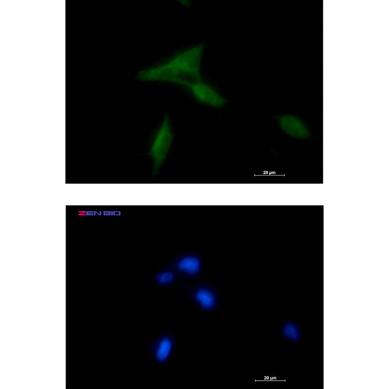 NDUFAF1 Rabbit Monoclonal Antibody