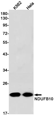 NDUFB10 Rabbit Monoclonal Antibody