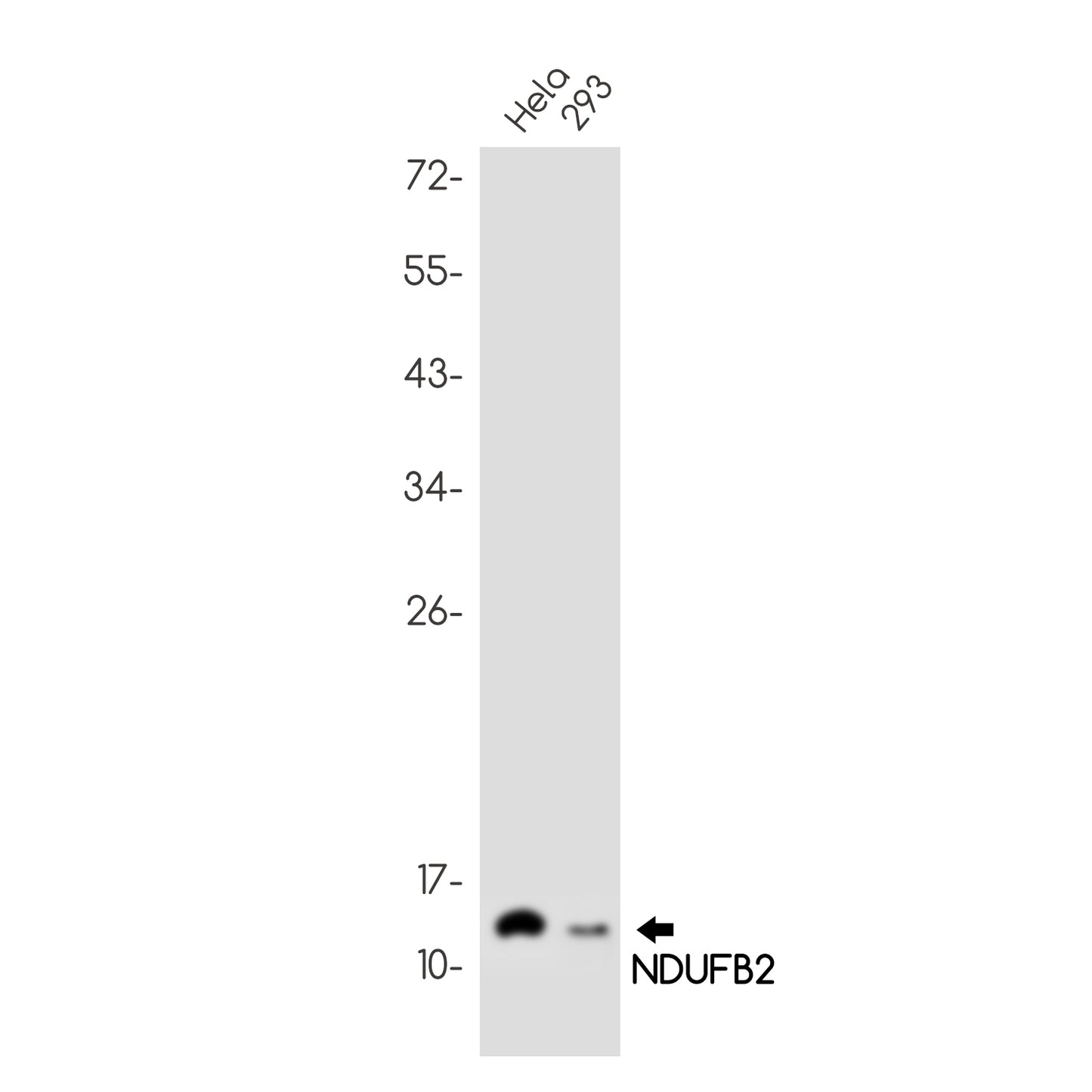 NDUFB2 Rabbit Monoclonal Antibody