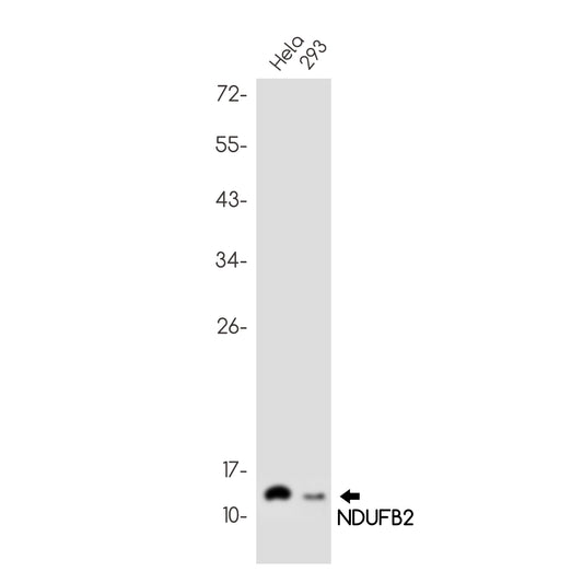 NDUFB2 Rabbit Monoclonal Antibody