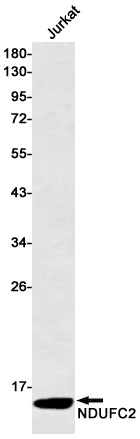 NDUFC2 Rabbit Monoclonal Antibody
