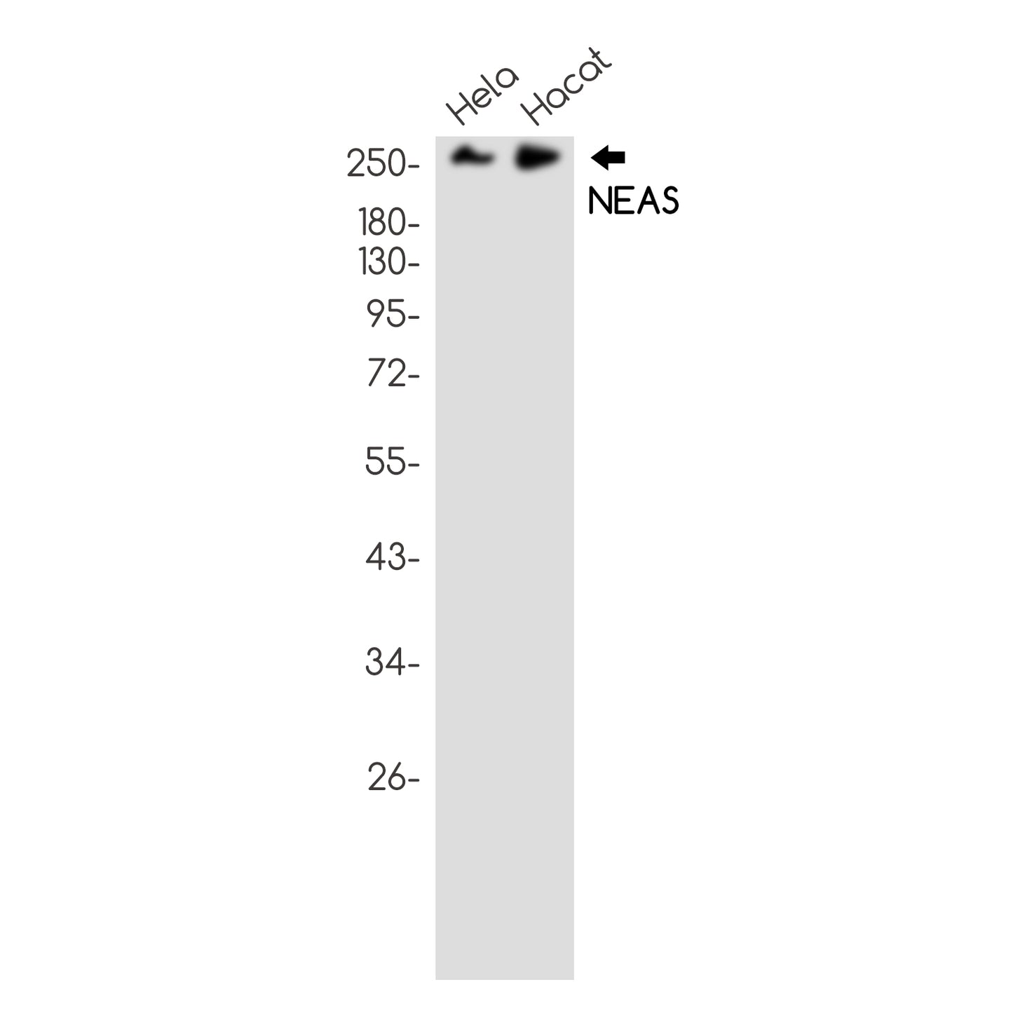 NEAS Rabbit Monoclonal Antibody
