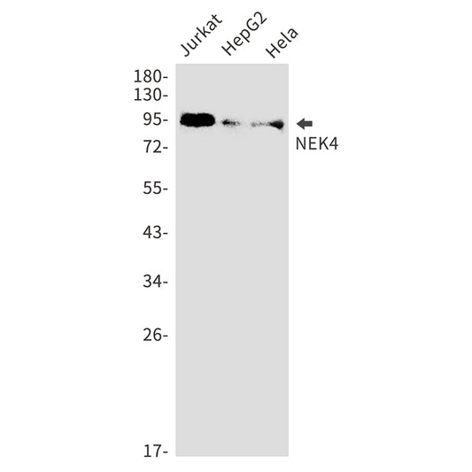 NEK4 Rabbit Monoclonal Antibody