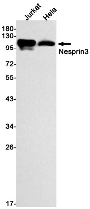 Nesprin3 Rabbit Monoclonal Antibody