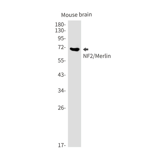 NF2 Rabbit Monoclonal Antibody