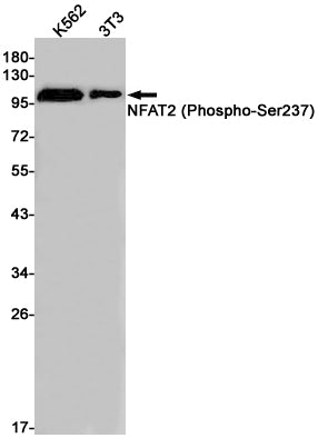 Phospho-NFAT2 (Ser237) Rabbit Monoclonal Antibody