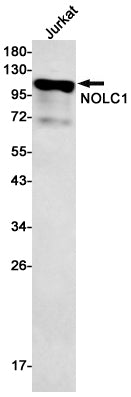 NOLC1 Rabbit Monoclonal Antibody