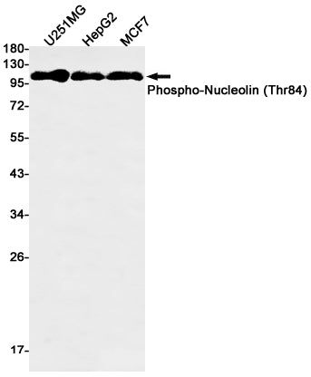 Phospho-Nucleolin (Thr84) Rabbit Monoclonal Antibody