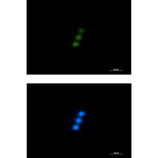NXF1 Rabbit Monoclonal Antibody