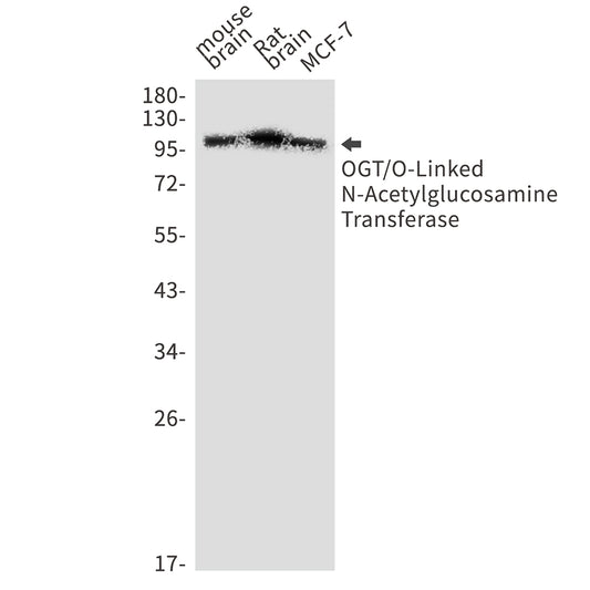 OGT Rabbit Monoclonal Antibody
