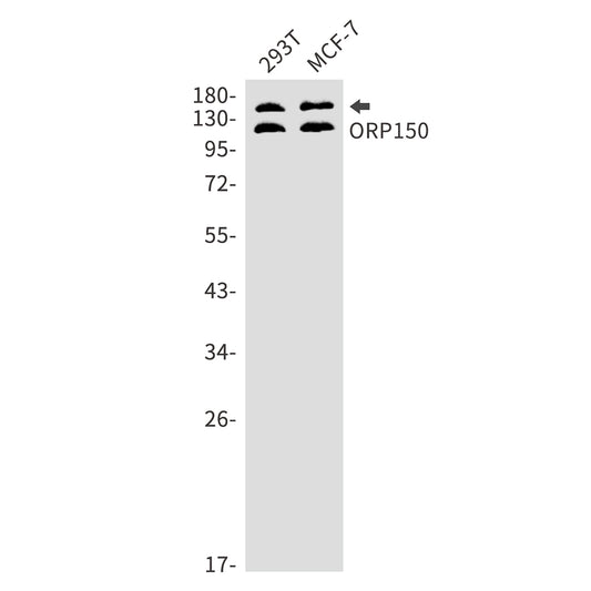 ORP150 Rabbit Monoclonal Antibody