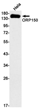 ORP150 Rabbit Monoclonal Antibody