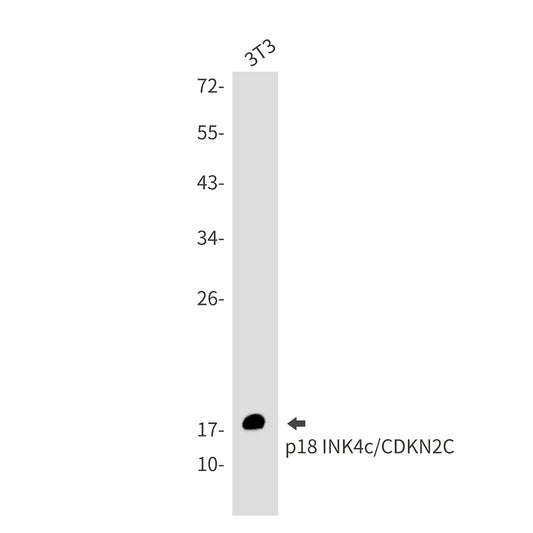 CDKN2C Rabbit Monoclonal Antibody