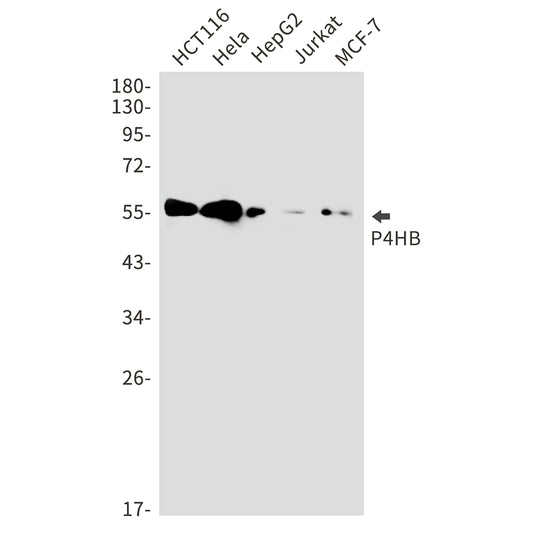 P4HB Rabbit Monoclonal Antibody