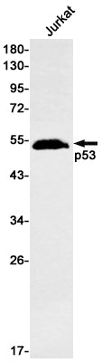 p53 Rabbit Monoclonal Antibody