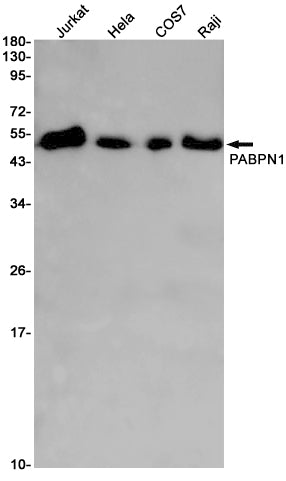 Polyclonal AntibodyPN1 Rabbit Monoclonal Antibody