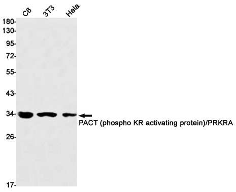 PRKRA Rabbit Monoclonal Antibody