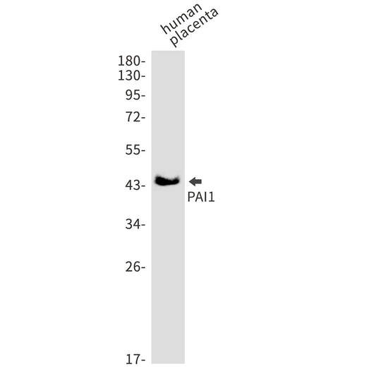 PAI1 Rabbit Monoclonal Antibody
