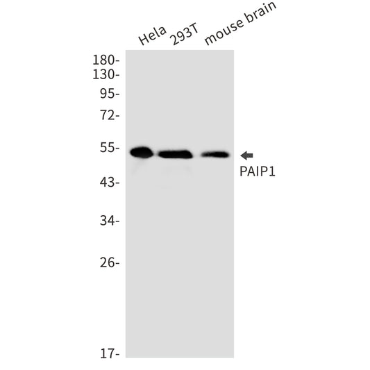 PAIP1 Rabbit Monoclonal Antibody