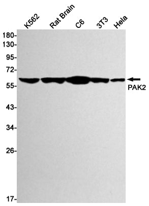 PAK2 Rabbit Monoclonal Antibody