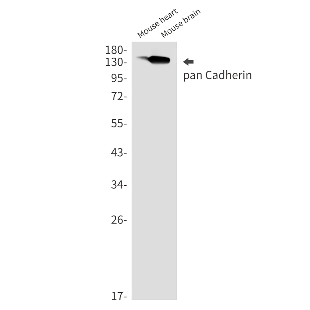 P cadherin Rabbit Monoclonal Antibody