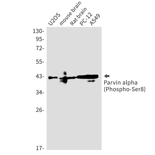 Phospho-Parvin alpha (Ser8) Rabbit Monoclonal Antibody