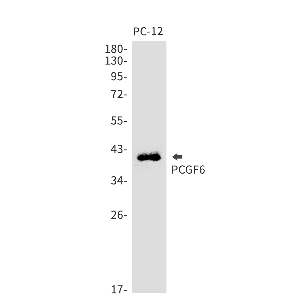 PCGF6 Rabbit Monoclonal Antibody