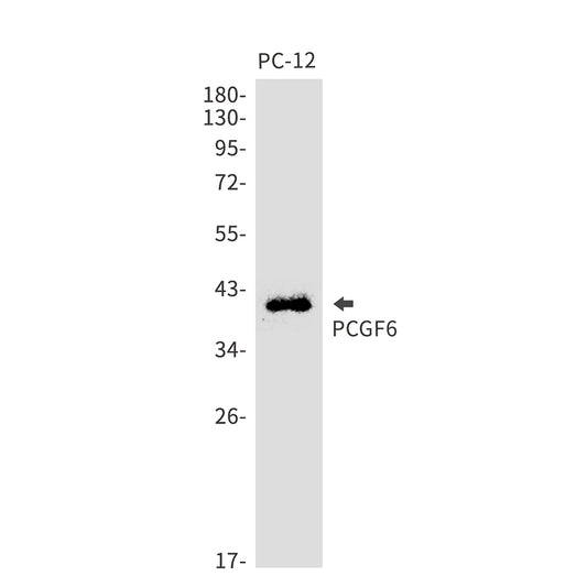 PCGF6 Rabbit Monoclonal Antibody